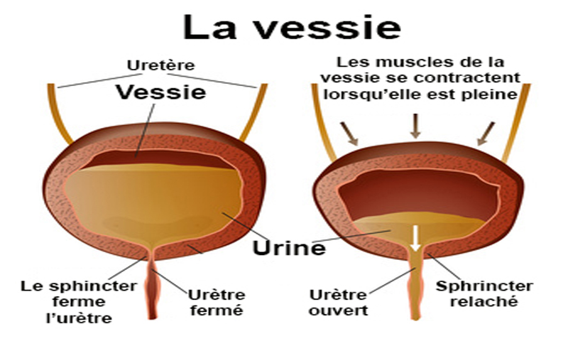 Le Dr Guy Malangu, affirme que la rétention des urines est dangereuse pour la santé humaine, car elle expose à plusieurs maladies pouvant s’aggraver et conduire à la mort.